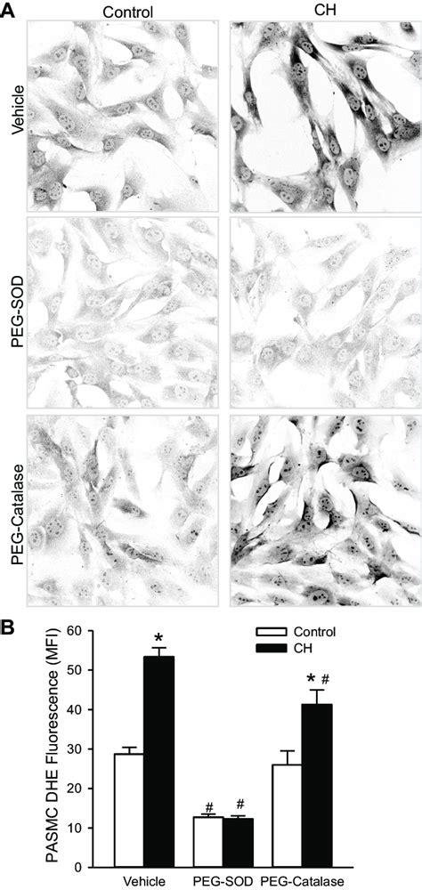 Chronic Hypoxia Ch Increases Pulmonary Artery Smooth Muscle Cell