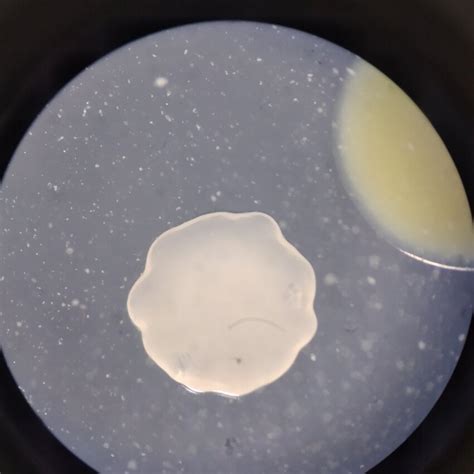 Is this contamination on my bacterial culture streak plate? | ResearchGate