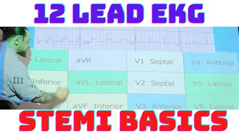 12 Lead EKG STEMI Basics: Inferior, Septal, Anterior, Lateral MI with ...