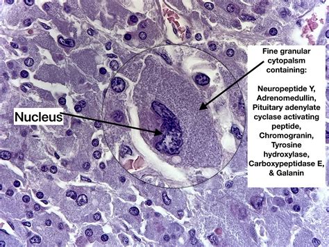 What rare tumor causes high blood pressure? Pheochromocytoma! Hormone