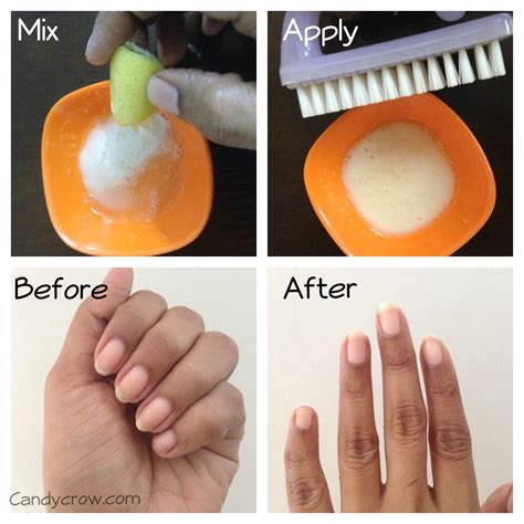 How to Get Rid of Yellow Nails Quickly? | Indian Beauty and Lifestyle blog