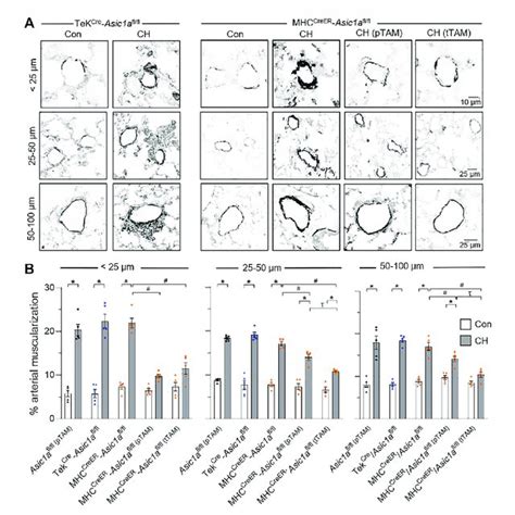 Sm Asic A Contributes To Vascular Remodeling Following Ch A