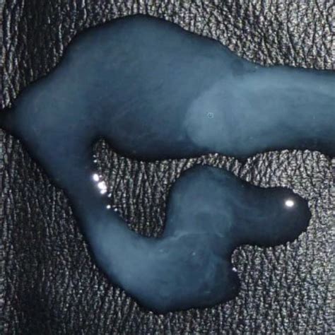 Czech Gay Massage Pt Xhamster