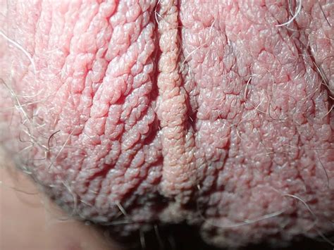 My Penis Up Close 20 Nude Pics XHamster