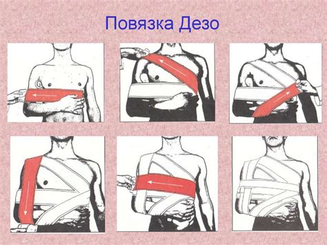 Походная медицина - презентация онлайн