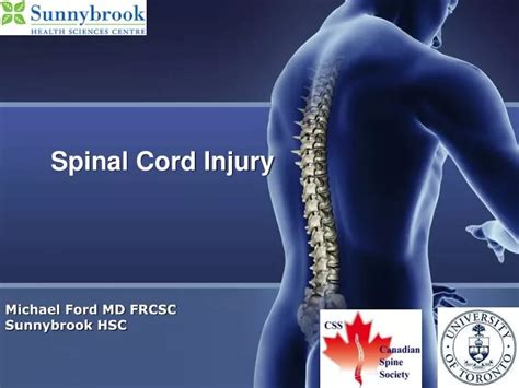 PPT - Spinal Cord Injury PowerPoint Presentation, free download - ID ...