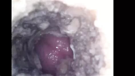 Plastic Pussy Fuck Xhamster