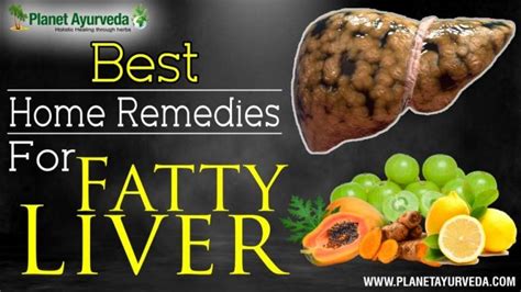 Home Remedies For Fatty Liver