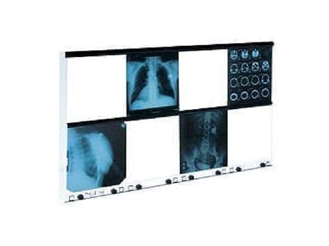 Ngp Hf X Ray Film Viewer Medicatech