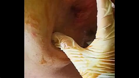 Deep Anal Training Part Xxx Mobile Porno Videos Movies IPornTV Net