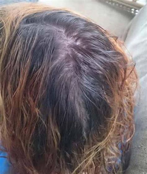 Girl ends up with black hair after buying Garnier Nutrisse blonde hair ...