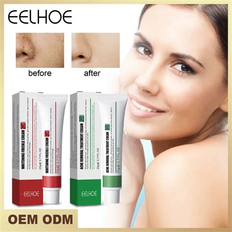 Eelhoe Whitening Freckle Cream G Lazada Ph