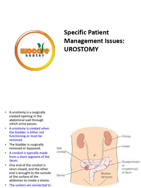 Specific Issue in Urostomy | PDF | Urine | Urinary Tract Infection