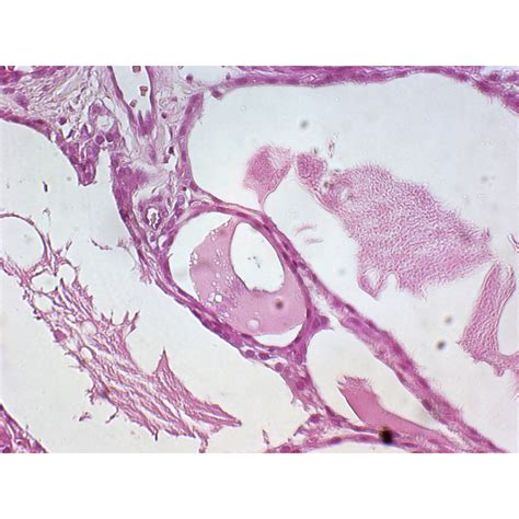 Human Pathology Prepared Slides - Prepared Slides - Slides - Microscopy