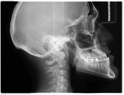 Xray X-Ray Radiology - Free photo on Pixabay