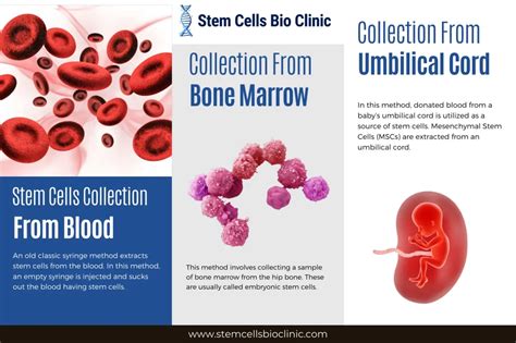 How are Stem Cells Collected? Painful or Just a Myth