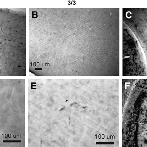 Vascular Amyloid Deposition Is Fibrillar Cerebral Cortical Section