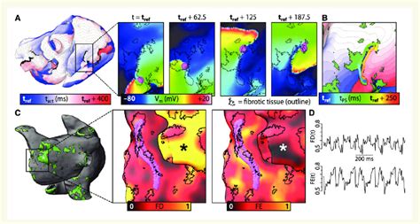 Relationship Between Reentrant Driver Localization And Fibrosis Spatial