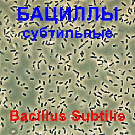 БАЦИЛЛЫ СУБТИЛЬНЫЕ - Bacillus subtilis / НОВОСТИ@probiotica.ru ...