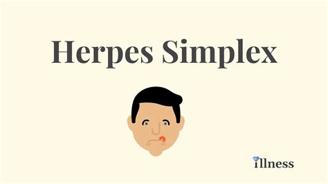 herpes simplex overview  symptoms treatment illnesscom