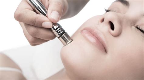 Skin Concerns That Benefit From Microdermabrasion Laser Clinics New