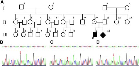 Frontiers Next Generation Sequencing Reveals A Case Of Norrie Disease