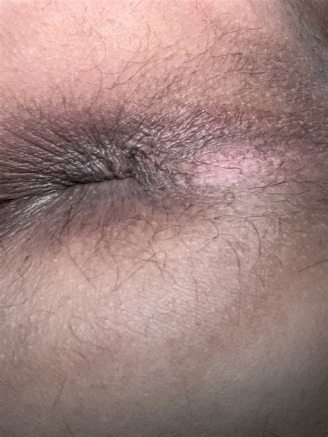 Cant Sleep Nude Pics XHamster