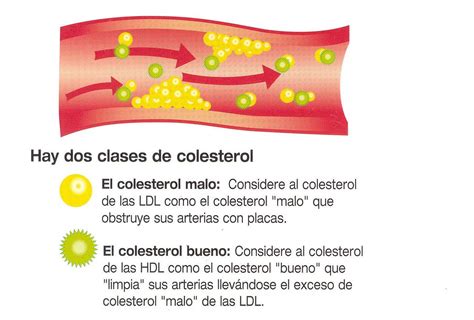 COLESTEROL ATEROESCLEROSIS Y ARTERIAS CORONARIAS