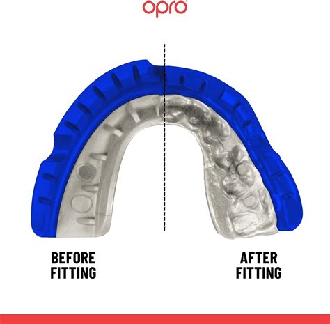Opro Mouthguard Self-fit Gen5 Dark Blue Pearl Braces – Chris Sports