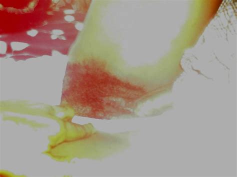 Yr Old Hairy Pussy Ebony Milf Nancy Showing Pussy Porn Pictures XXX Photos Sex Images