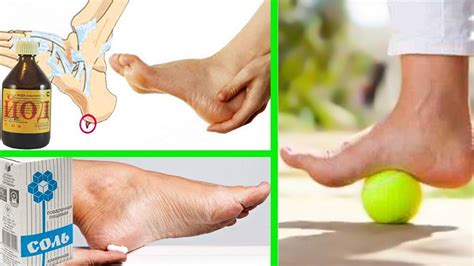 Шпоры в пятках: лечение в домашних условиях