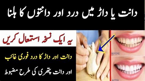 Dant Danton Danto Ka Dard Ka Ilaj Teeth Pain Relief Home Remedy