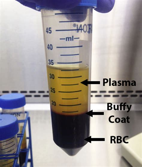 Centrifugation Tube And Contents After First Centrifugation After The