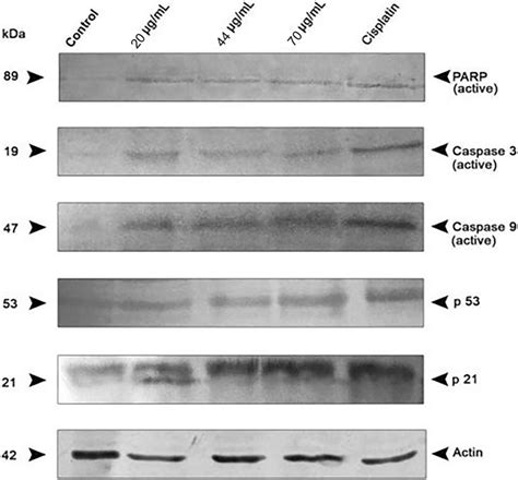 Western blot analysis of apoptosis-related protein expression of PARP ...