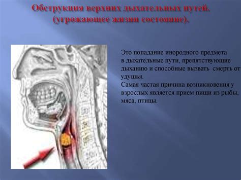 Реанимация у детей до года. Восстановление проходимости дыхательных ...
