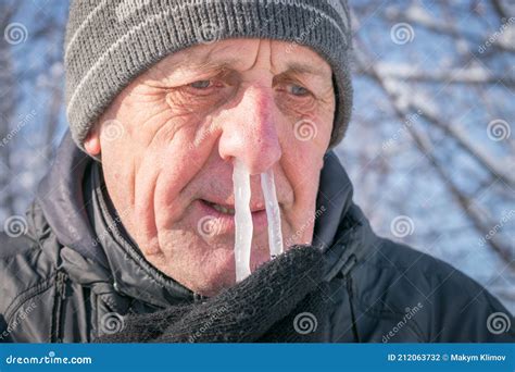 The Man`s Snot Was Frozen In His Nose Portrait Of An Elderly Man With