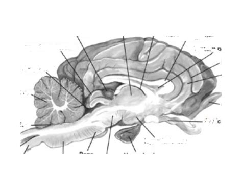 Pig Brain Quiz