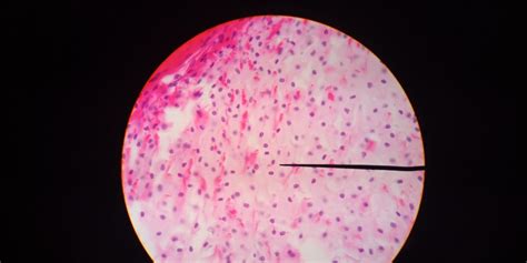 Dense Regular Connective Tissue – Anatomy