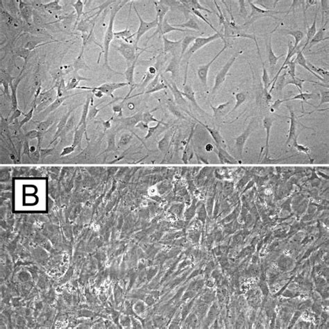 Cell culture experiments of retinal pigment epithelium cells. Retinal ...