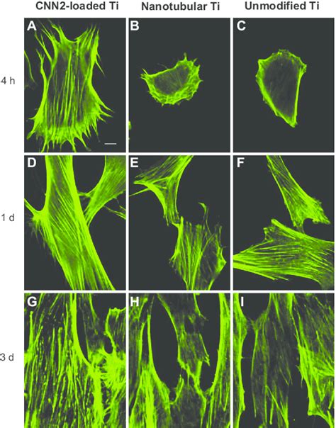 Fluorescent images of actin cytoskeleton among fibroblasts reacting to ...