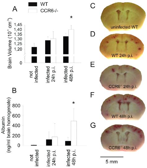 CCR6 Deficient Mice Suffer From Increased Brain Edema After Antibiotic