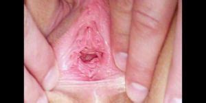 Lynn Gyno Pussy Speculum Examination At Clinic Video Porn Videos