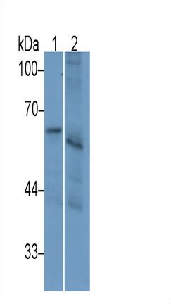 monoclonal antibody  interleukin  receptor beta ilrb bha
