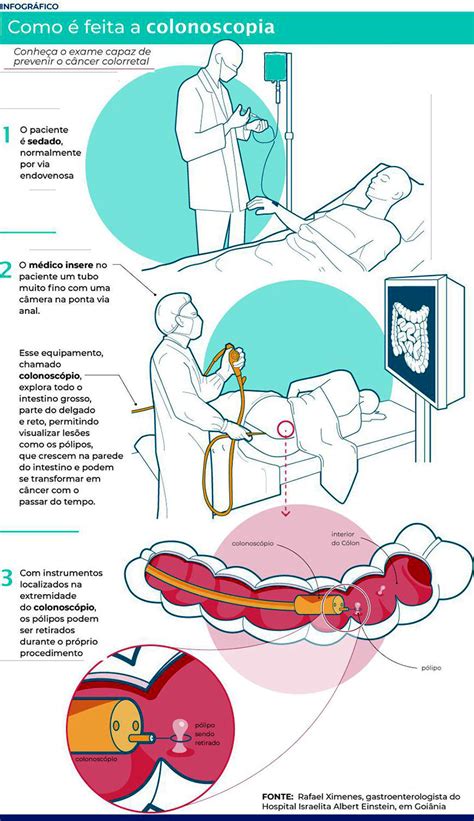 Mortalidade Por C Ncer Colorretal Cresce Na Am Rica Latina