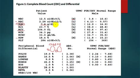 Anemia Blood Levels Chart