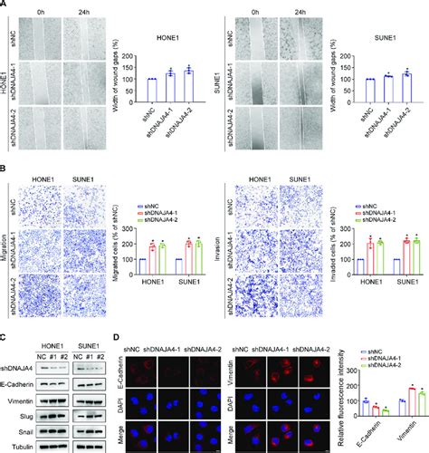 Knockdown Of DNAJA4 Promotes NPC Cell Migration Invasion And EMT A