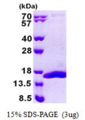 Recombinant Human COX5b His Protein NBP2 22982 By Novus Part Of Bio