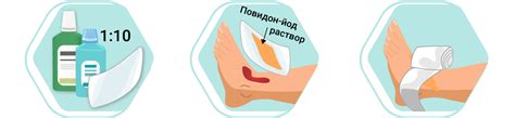 Обработка ран
