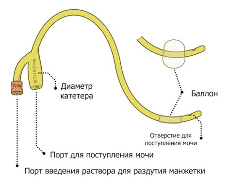 Катетер Фолея для мужчин. Методика установки - WETLAB