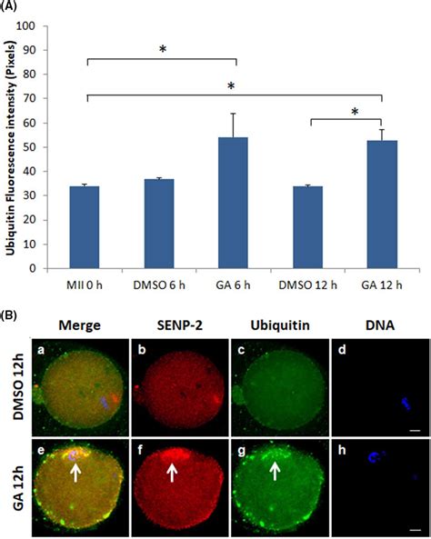 Postovulatory Aging Is Associated With Altered Patterns For Small